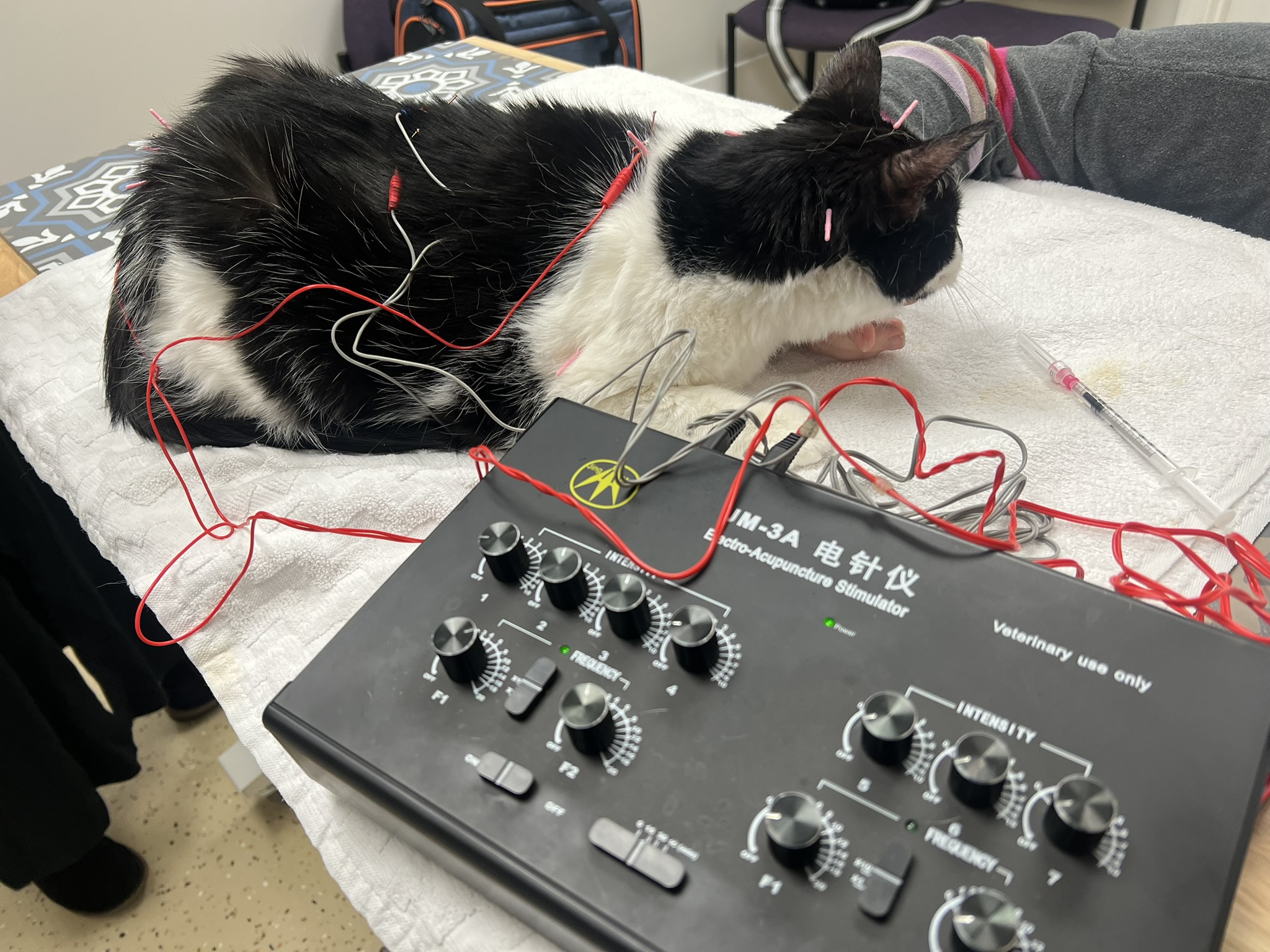 Acupuncture therapy session